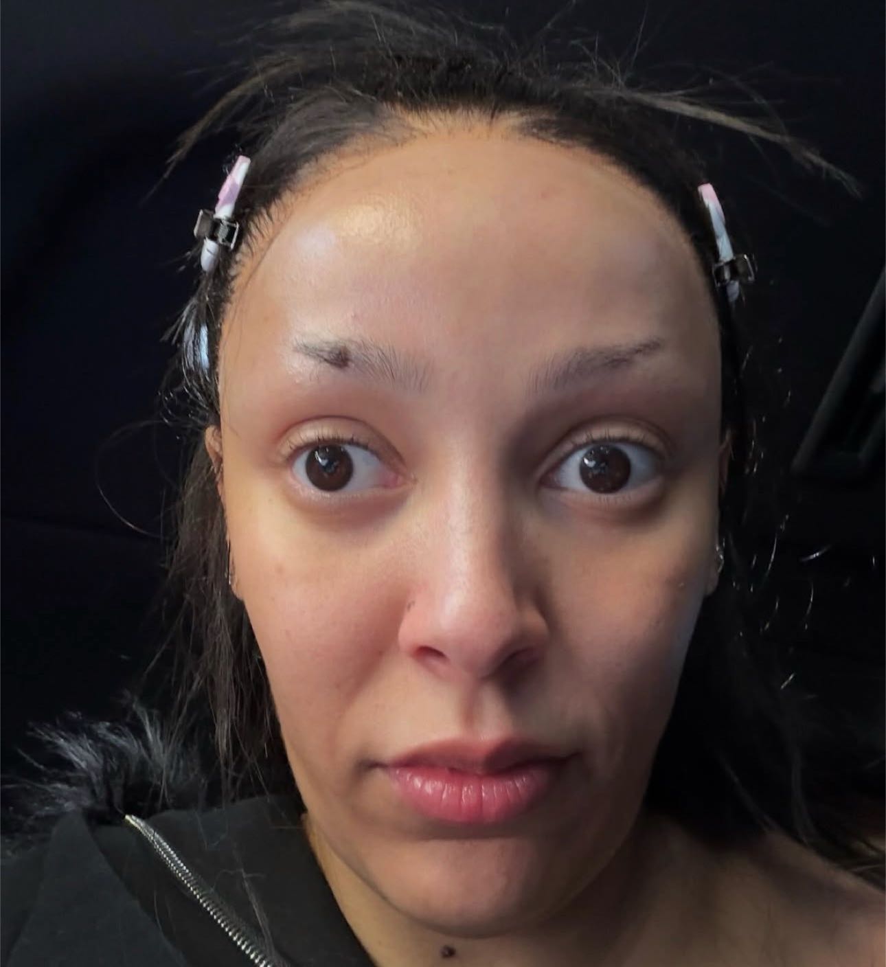 Post attachment
