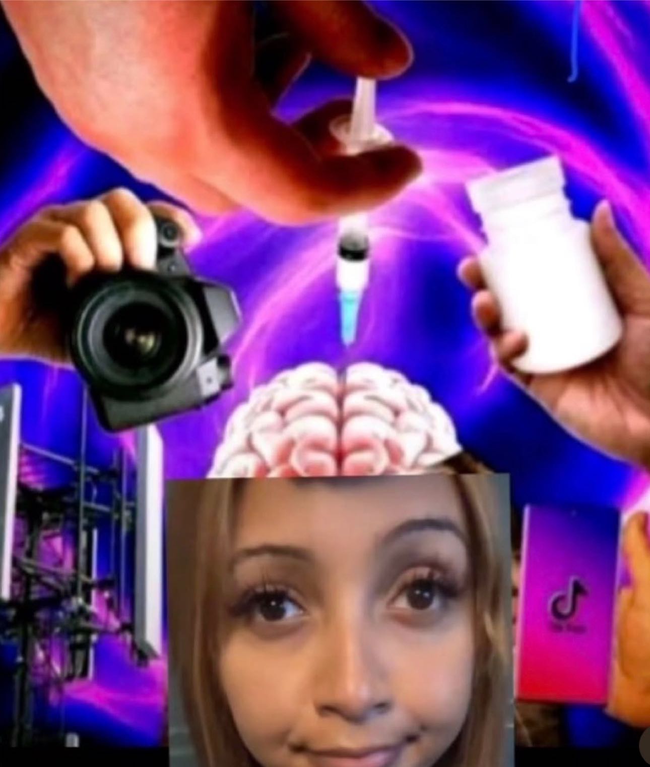 Post attachment